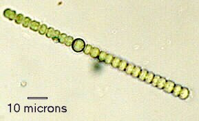 anabaena met heterocyst